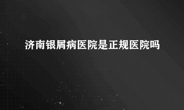 济南银屑病医院是正规医院吗