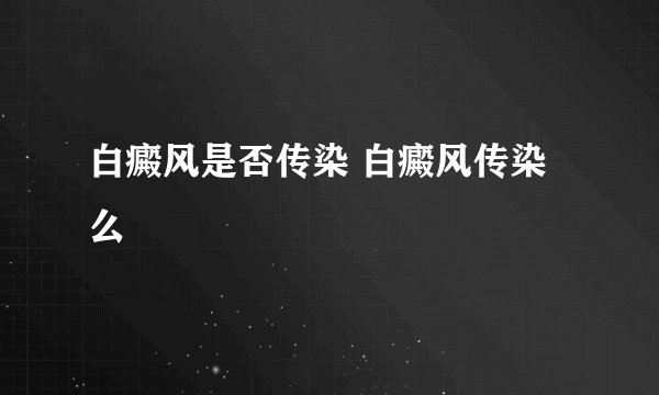 白癜风是否传染 白癜风传染么