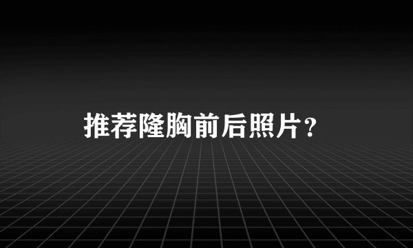 推荐隆胸前后照片？