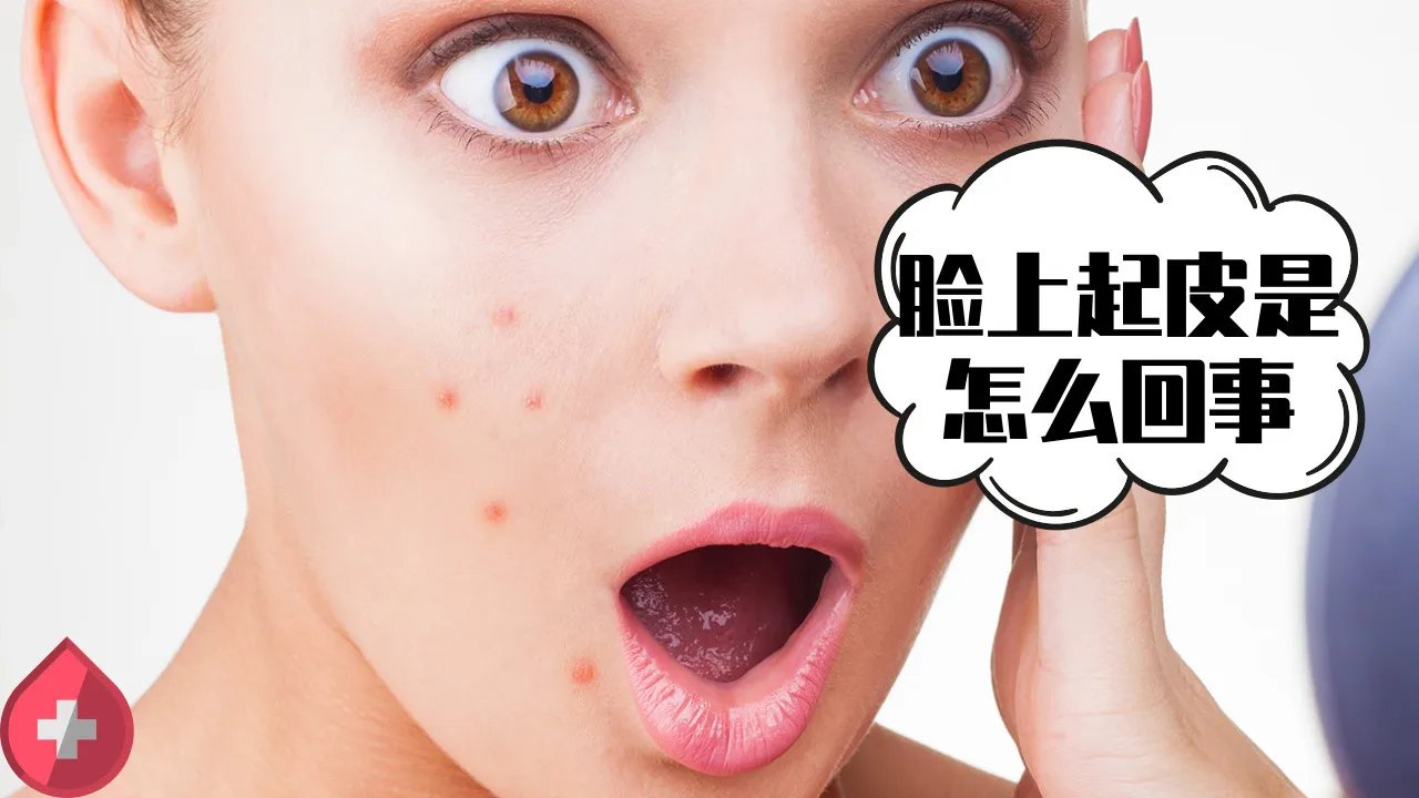 脸上起皮是怎么回事