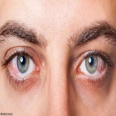 视盘血管炎是如何引起的