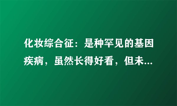 化妆综合征：是种罕见的基因疾病，虽然长得好看，但未必是好事