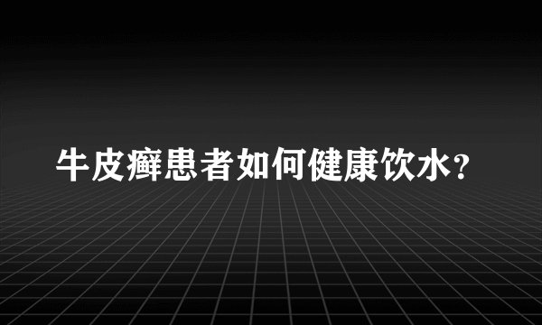 牛皮癣患者如何健康饮水？