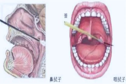 核酸采集的部位图片