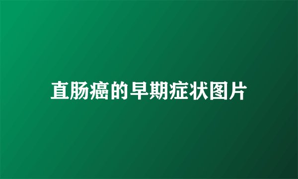 直肠癌的早期症状图片
