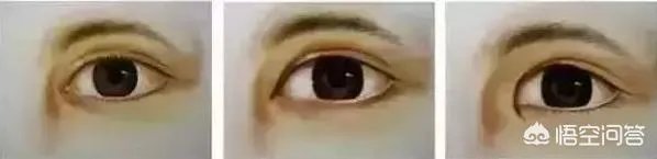 割双眼皮到底该不该开不开眼角?