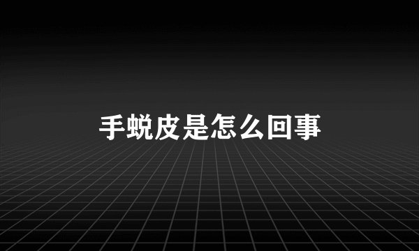 手蜕皮是怎么回事