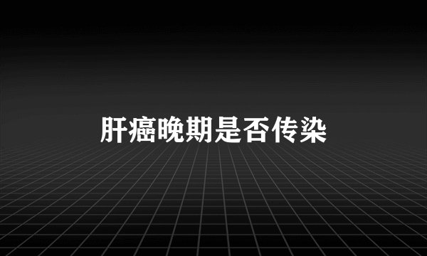 肝癌晚期是否传染