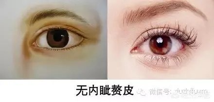 割双眼皮到底该不该开不开眼角?