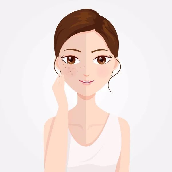 脸部永久脱毛方法