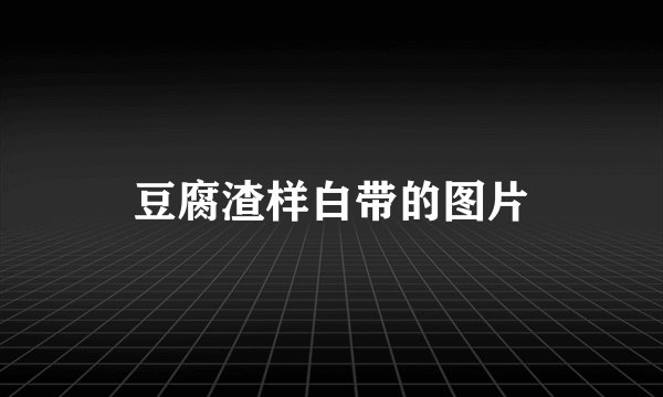 豆腐渣样白带的图片