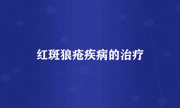红斑狼疮疾病的治疗