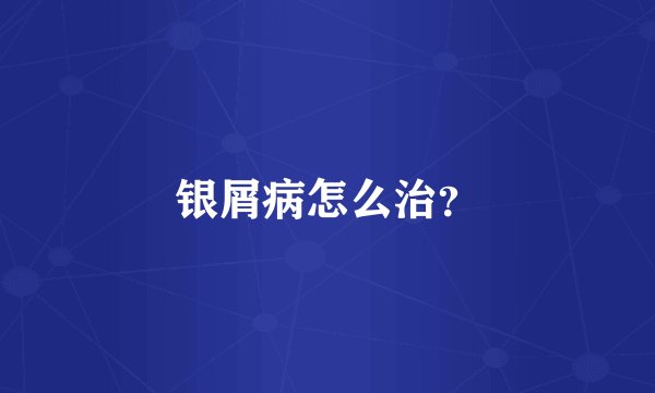银屑病怎么治？