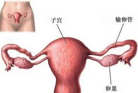 子宫癌是怎样的？