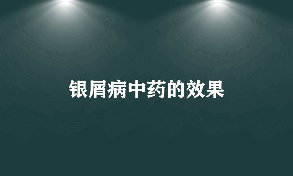 银屑病中药的效果