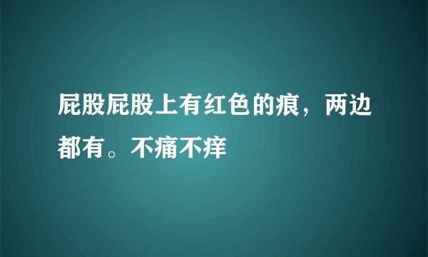 屁股屁股上有红色的痕，两边都有。不痛不痒