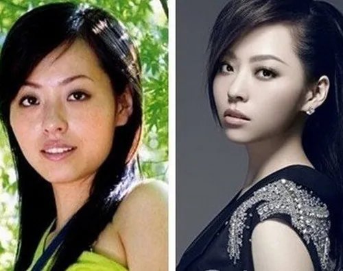 张靓颖整容前后照片对比 自曝素颜照力证无大小眼