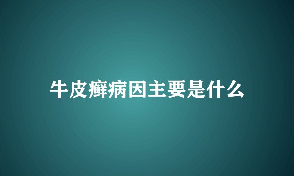 牛皮癣病因主要是什么