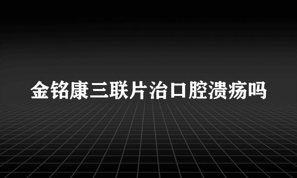 金铭康三联片治口腔溃疡吗